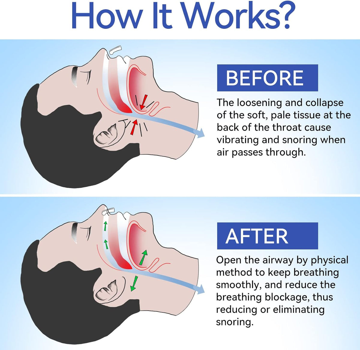 Anti Snoring Nose Clip Device for Men and Women Sleep Aid